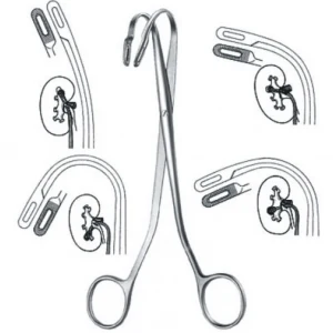KIDNEY INSTRUMENTS